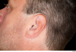 Paul Mc Caul ear 0002.jpg